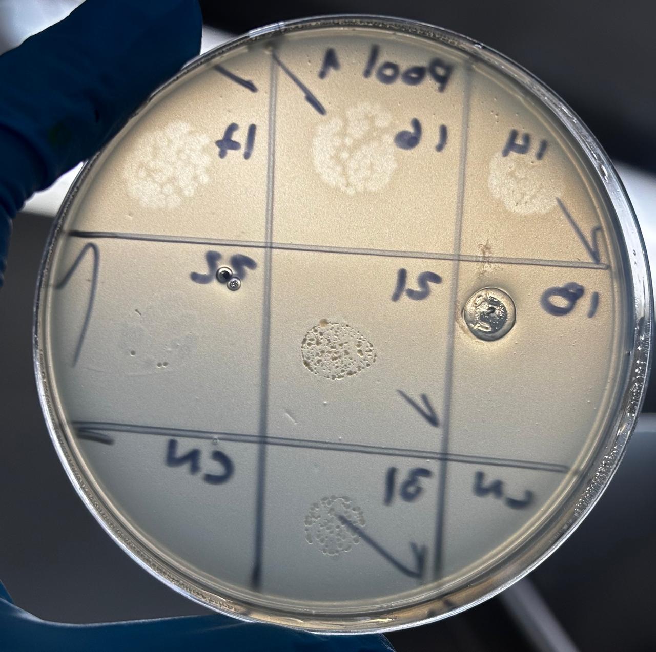 Ensayo de placas de fagos en placa de Petri